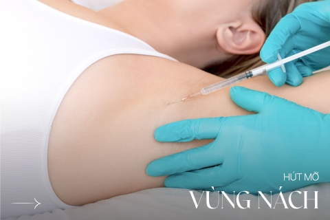 Hút mỡ vùng nách